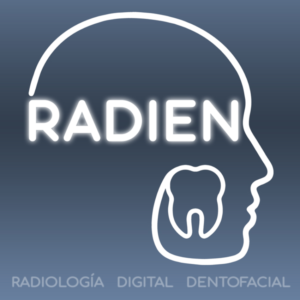 Radien, Jalapa